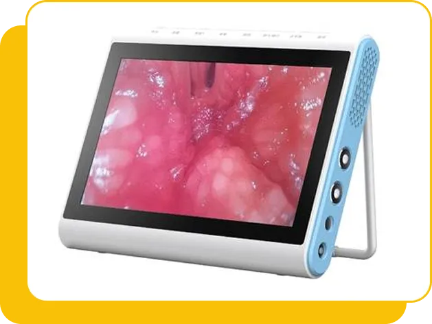 besdata hysteroscope machine dubai